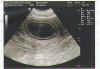 ultraschall_u_litter.JPG (89816 Byte)
